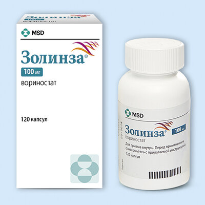 Золинза