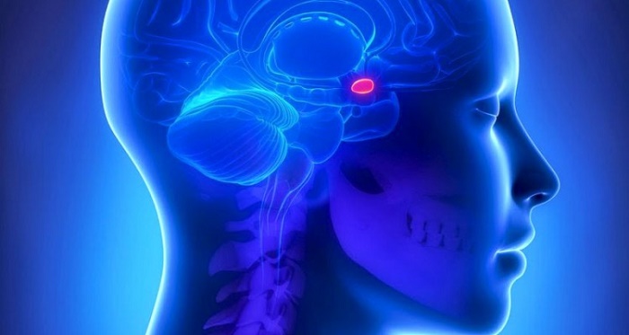 Аденома гипофиза
